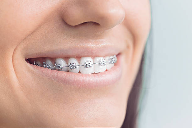 Laser Dentistry in Calverton Park, MO